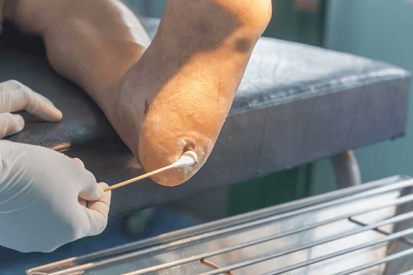 Leg and Diabetic Ulcer Treatments